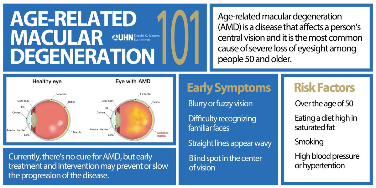 #DYK: Age-related macular degeneration (AMD) is the leading cause of vision loss in people over the age of 50, affecting approximately 2.5 million Canadians. Learn more about #AMD and our current research @DKJEI_UHN >> uhn.ca/EyeInstitute #VisionHealthMonth