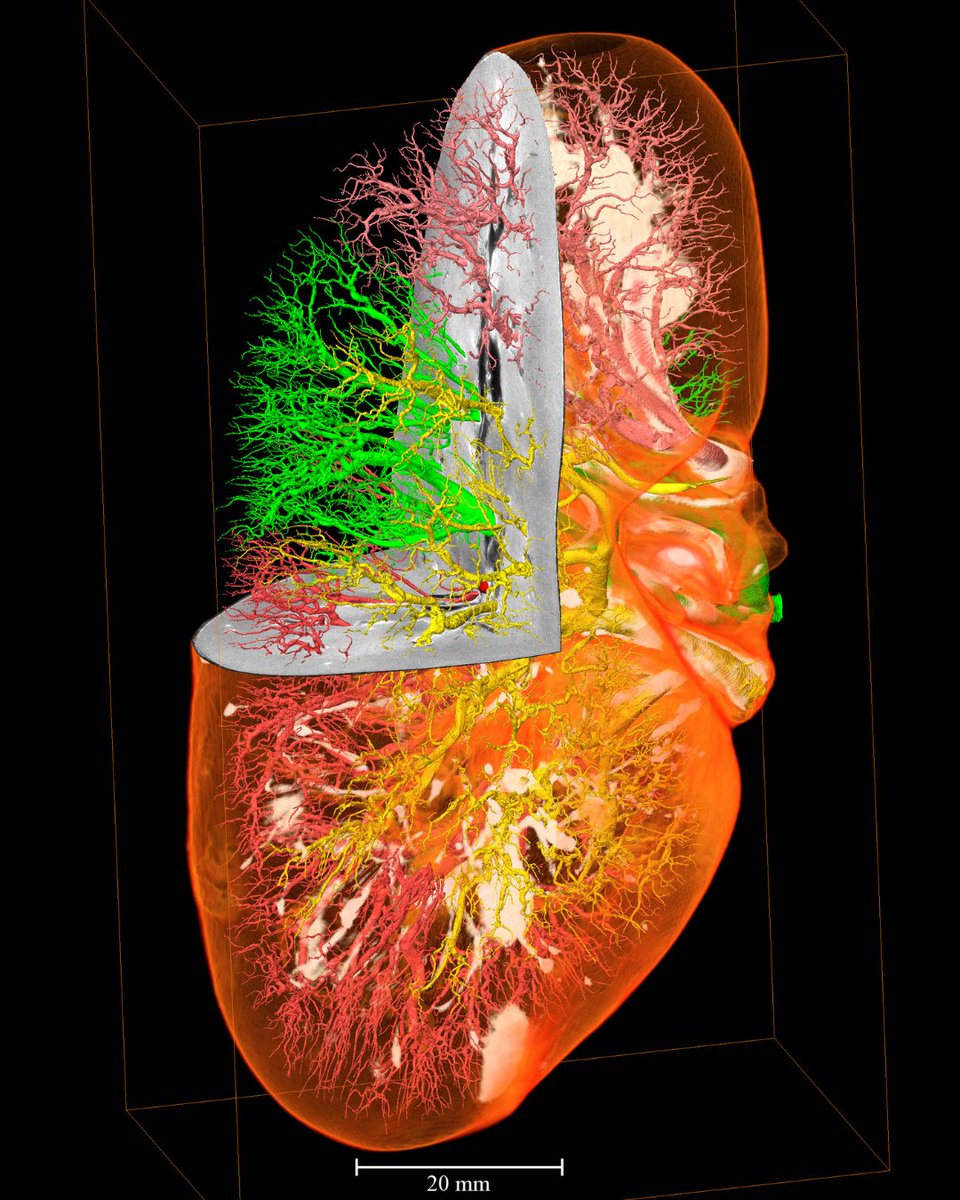 By employing very high-resolution CT scans of entire human kidneys, @Sarahteichmann1 + @hip_ct team are linking our knowledge of molecular changes to an imaging modality. It is a step towards linking cell atlas data to clinical imaging