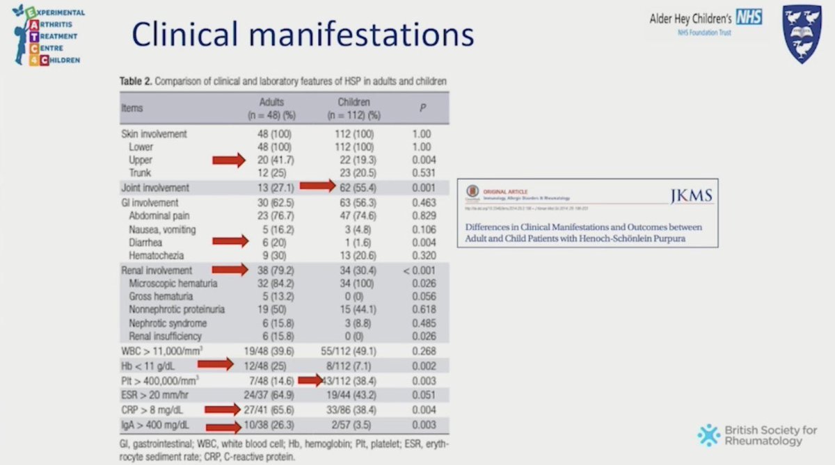 IgA #Vasculitis 

Comparison of clinical manifestations Adults Versus Children

Worse #Renal outcomes in adults ⬆️ risk of chronic kidney disease. Upper limb vasculitic rash. Prognosis generally better in children with 90% full recovery at 2Y

[Dr Louise Oni]

#BSR24 #MedTwitter