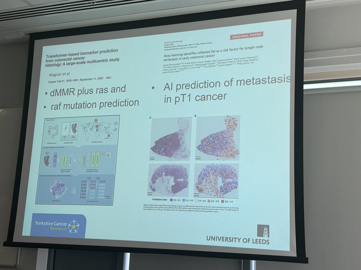 Fantastic to showcase our colorectal cancer research to @yorkshirecancer fundraising partners, led by Phil Quirke and @DrSue2017. Exciting advances using digital pathology, AI biomarkers, radiotherapy and the microbiome! @UniversityLeeds @LeedsHospitals