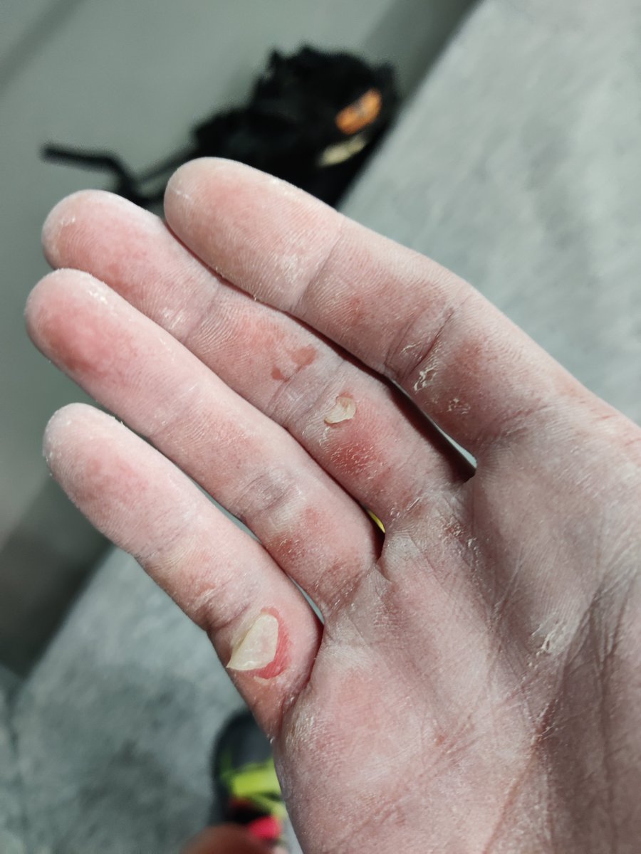 Top rope climber goes bouldering 😔