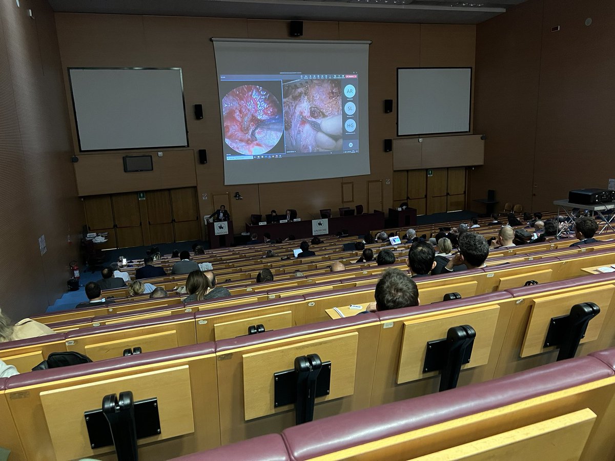 EESminnesota's tweet photo. Today in Modena: enjoying a full morning of endoscopic and microscopic live ear surgeries by Prof. Presutti and Prof. Marchioni at the 2024 International Workshop on Ear Surgery. https://t.co/E8aFPLxpVc