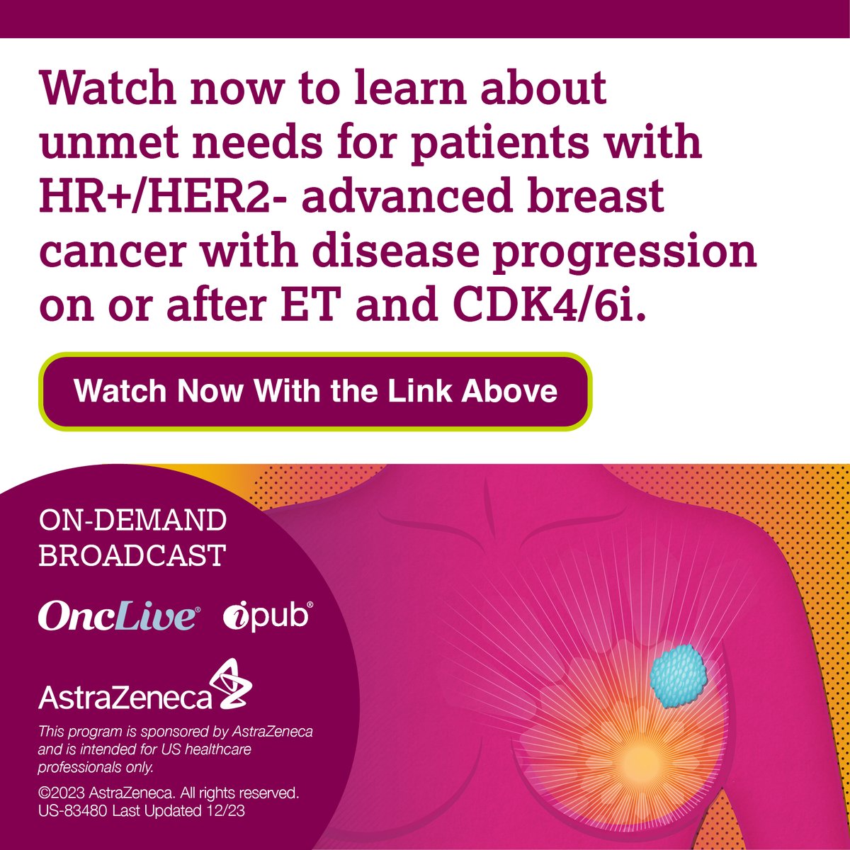 Watch the on-demand broadcast to discover unmet needs in the 2L treatment of HR+/HER2- advanced breast cancer and the role of the PI3K/AKT/PTEN pathway in endocrine therapy resistance. bit.ly/47WHmzI