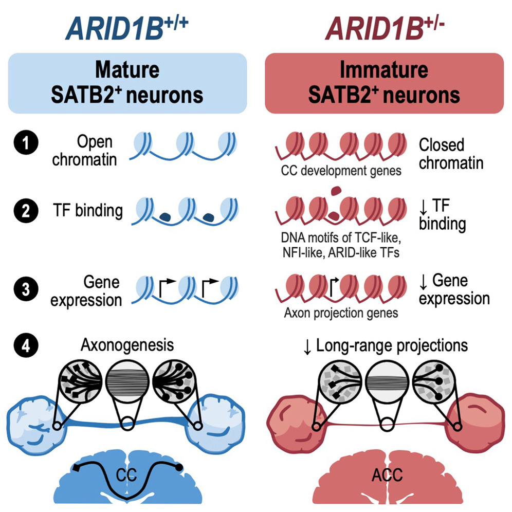 Researchers found that 🧠 #neurons expressing SATB2, a determinant of callosal projection neuron (CPN) identity, show impaired maturation in ARID1B+/− neural #organoids. 📖 @CellStemCell | bit.ly/3QAkn6Y