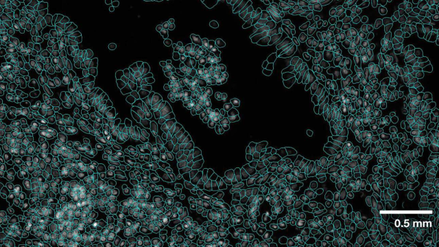 Enhance cell analysis with NVIDIA's VISTA-2D. Revolutionize cell segmentation and morphology analysis for #genomics research. Join the early access program to leverage this transformative technology. #AI bit.ly/3wpKTt3