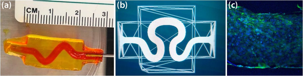 The successful #TissueEngineering of skin grafts requires the careful selection of parameters. Read about an #experimental system that investigate parameters like #3DPrinting techniques and channel tortuosity in SIAM News Online! @NSF #DMSFunded sinews.siam.org/Details-Page/o…