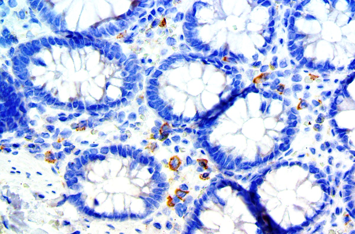 You’re not col-lone in your IHC labs - Bio SB’s technical support and applications team is ready to work alongside you to help optimize protocols and make sure your stains are always looking great. This Colon tissue has been stained using Bio SB’s CD33 (RBT-CD33) RMab Antibody