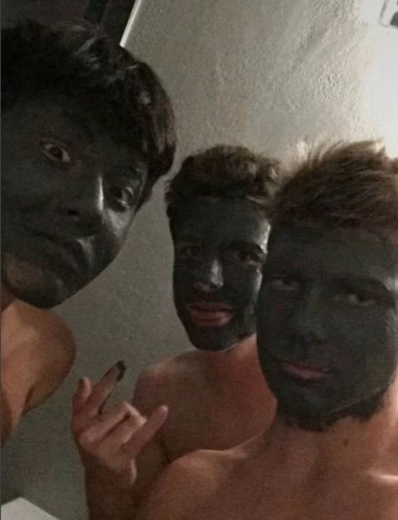 🚨I 🇺🇸 Dos adolescentes de California han sido indemnizados con 1 millón de dólares tras ser injustamente acusados de '#blackface' por publicar una fotografía en la que llevaban crema para el acné, lo que resultó en su expulsión de la prestigiosa Saint Francis High School.