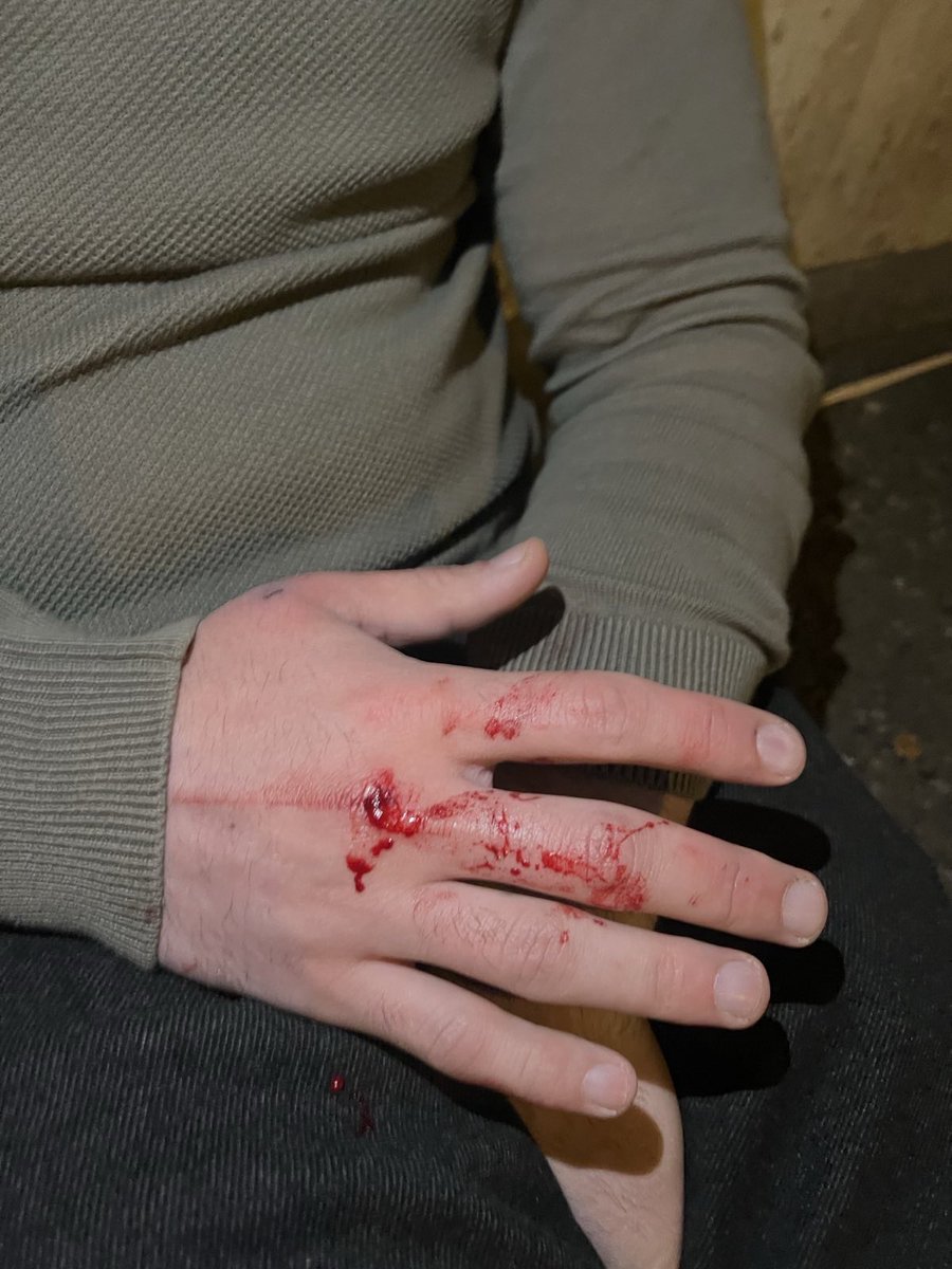 Our party leader Boris “Chele” Kurua has just been physically assaulted at his own home entrance by titushky! @GeorgianDream41 actively plans physical assaults of the opposition and activists for the past 2 days