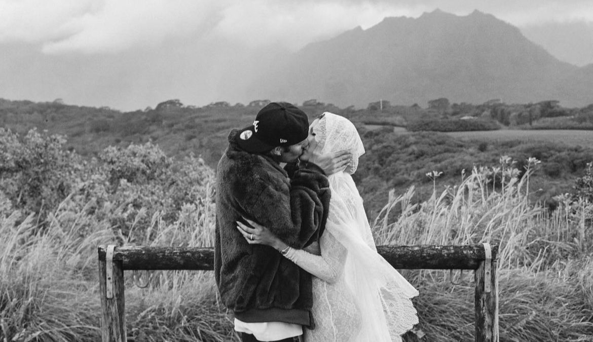 .@justinbieber and his wife are expecting their first child 🫶🏽