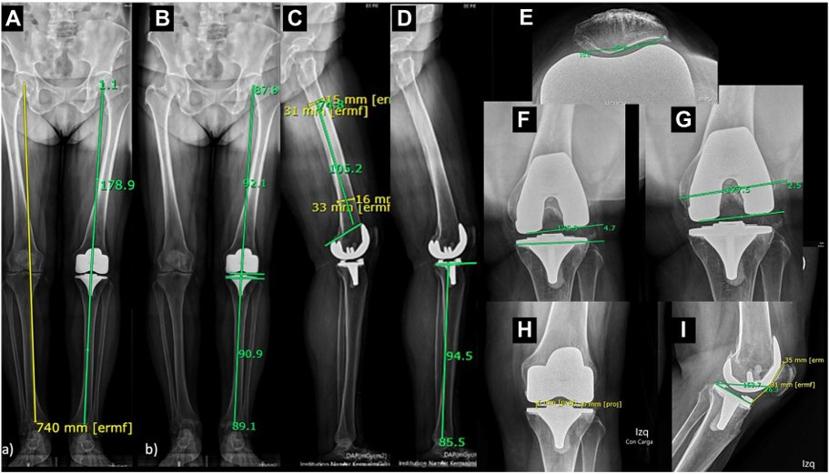 The Journal of Arthroplasty tweet media