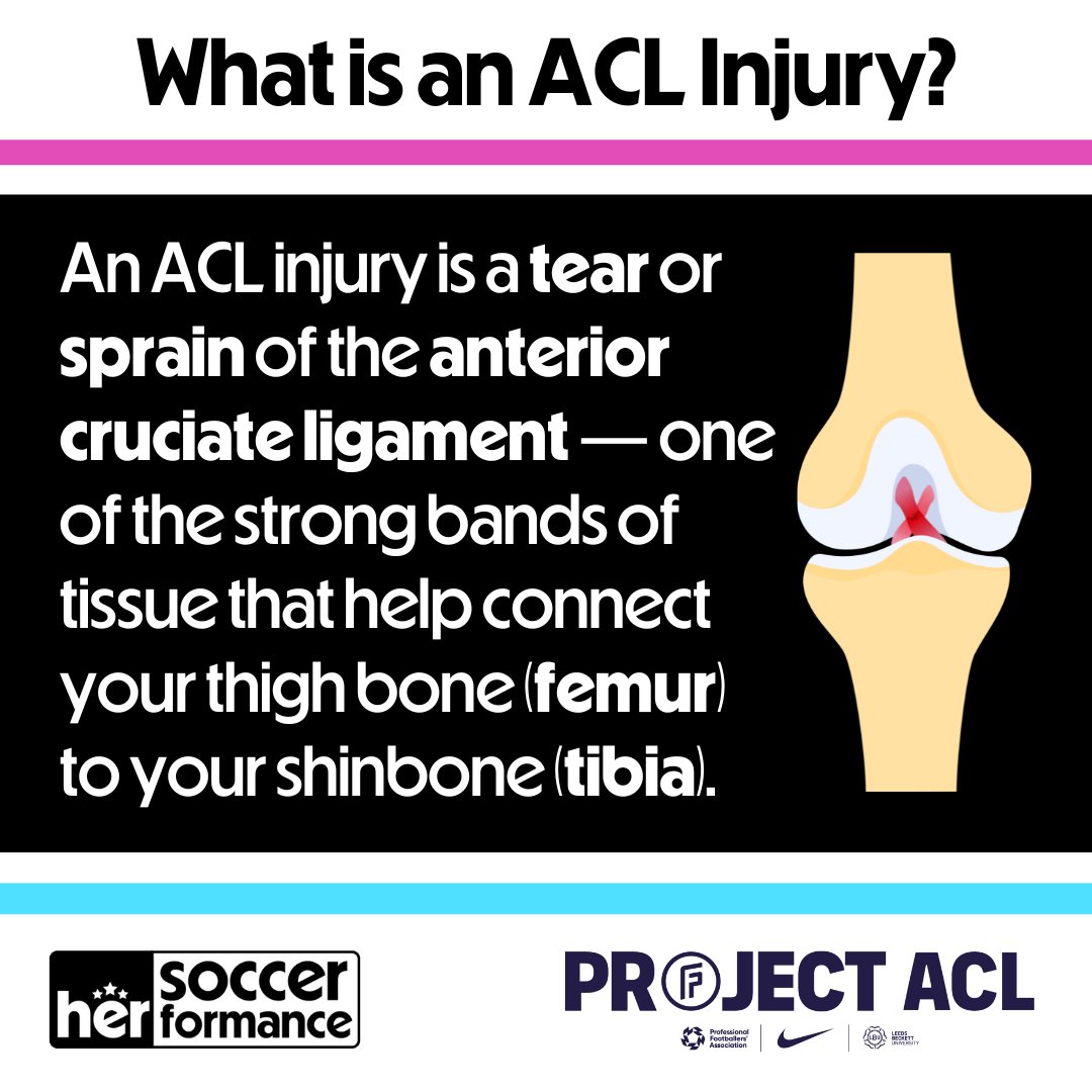 soccerherform's tweet image. There is still a lot of work to be done in preventing ACL injuries in women’s soccer, but Project ACL&apos;s effort and dedication to improving the women’s game, is a major step in the right direction.

@leedsbeckett @FIFPRO @PFA @Nike

#aclinjuries #projectACL #womensaclinjuries