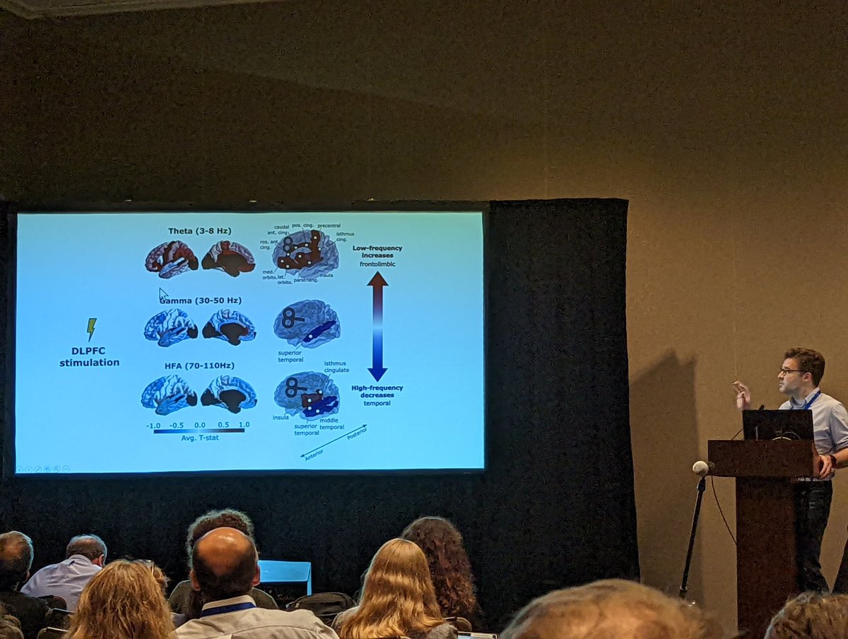 Fantastic presentation at #SOBP2024 by @esolomon on the intracranial neural responses to TMS! 🧠 ⚡ In collaboration with @boeslab @JeffreyBondWang @NickTrapp13 @StanfordBrain biorxiv.org/content/10.110…