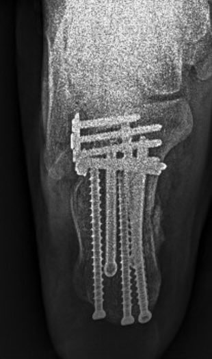 The Chosen One tweet media