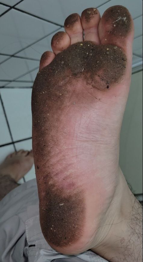 DirtyBlackFeet's tweet photo. Feel close to my sole 👀

#dirtyfeet #dirtysoles #barefoot #barefootboy #barefooter #descalzo #scalzo #patassucias https://t.co/2Kraepo6ZG