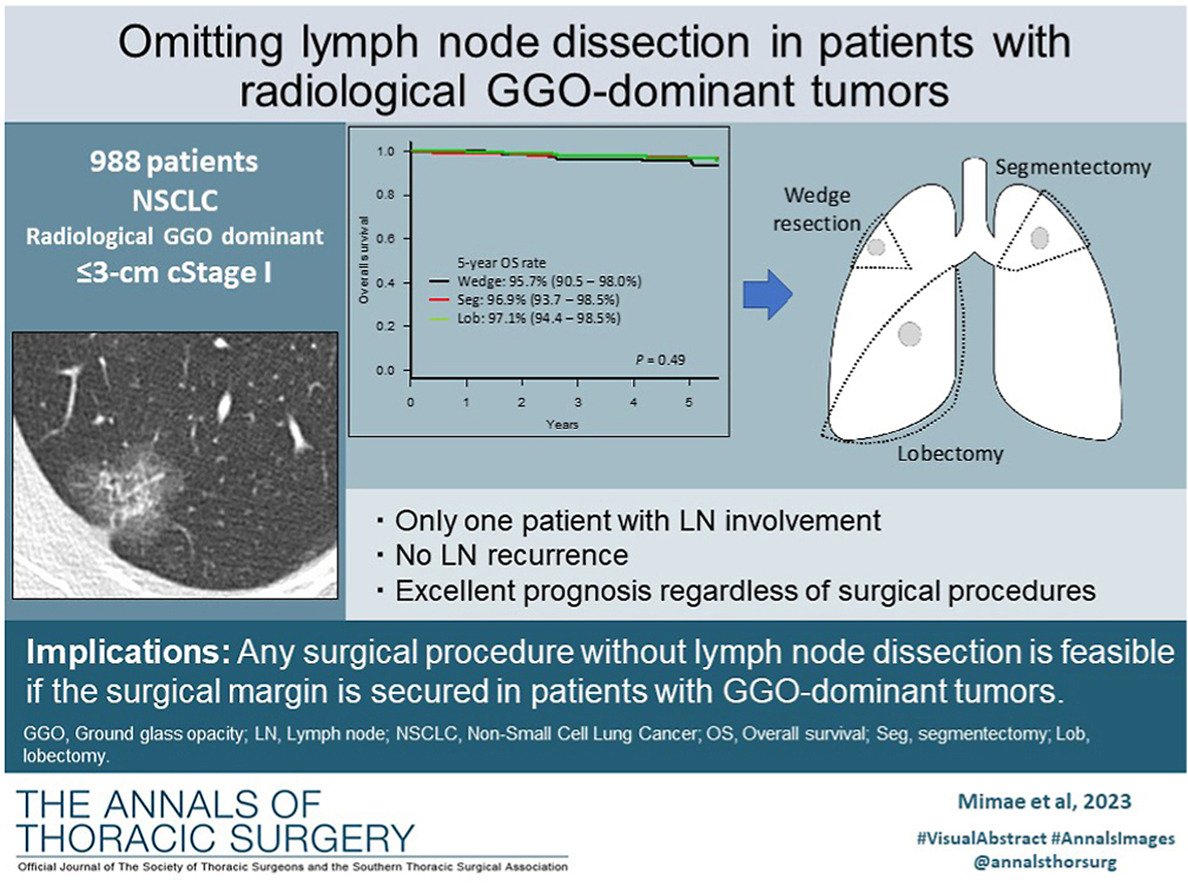 A Japanese study evaluated the purported concern of omitting LN dissections during lung cancer surgery for GGO-dominant lung cancers. It calls into question why surgery is offered for this population in the first place. #lcsm #CSP2005 sciencedirect.com/science/articl…