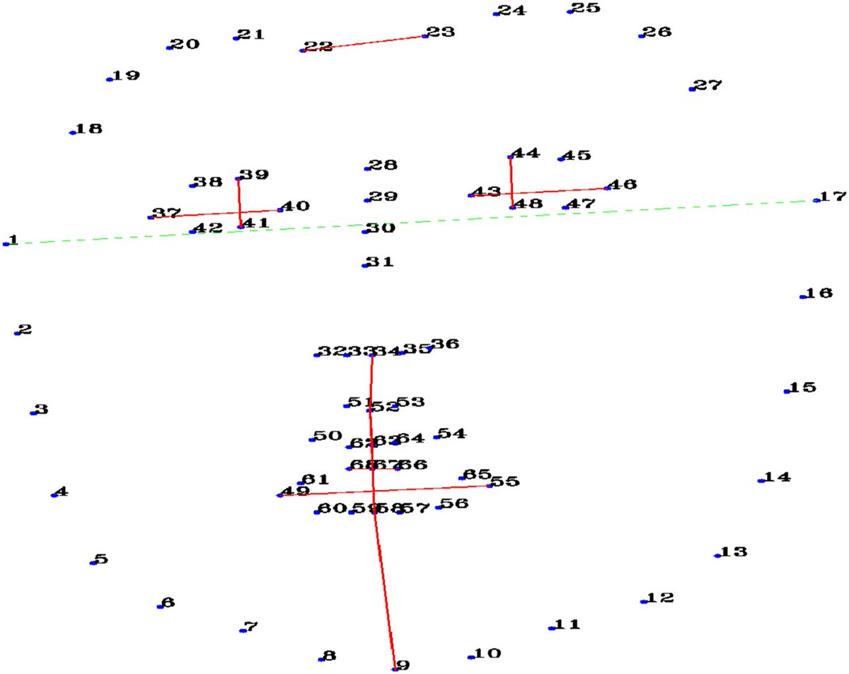 Out Now！An #innovative #method for detecting #depression #phenomics link.springer.com/article/10.100…