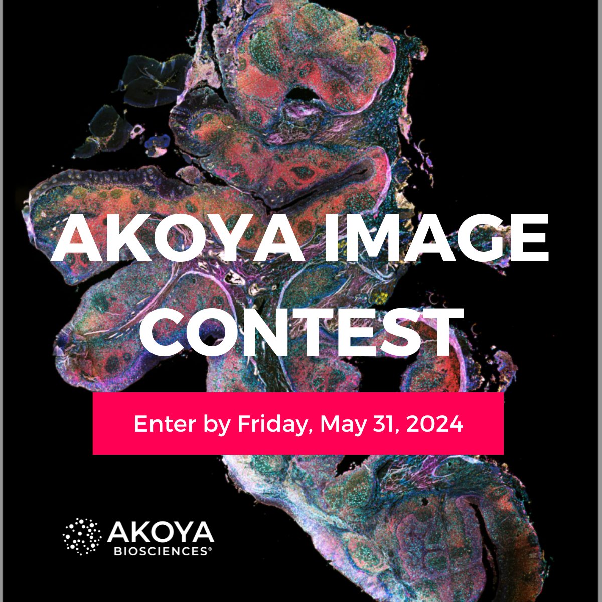 📸 Got an image that inspires? We're seeking captivating captures that showcase the artistry of #spatialbiology. Submit your mesmerizing tissue images using Akoya's technology for the chance to be featured on our platforms and a $100 Amazon gift card: bit.ly/3TfdR7x