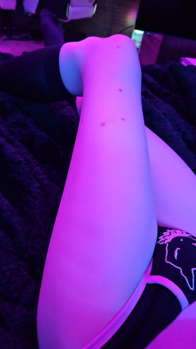 y is a spider biting tf outta my tiny thighs like a snack while i sleep 😭😭😭 https://t.co/Ye2sODykTA