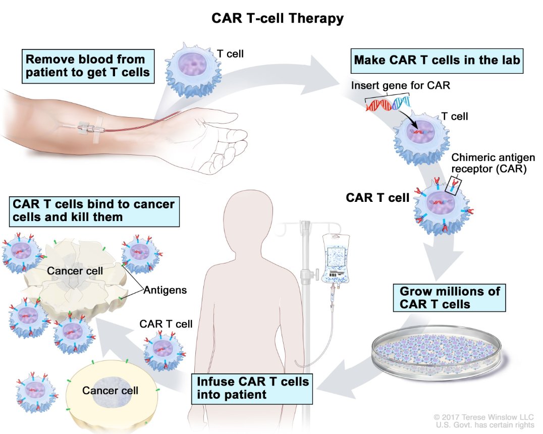 India: First patient declared ‘cancer-free’ using CAR-T cell therapy

wionews.com/india-news/ind…

CAR T-cell therapy. A type of immunotherapy treatment in which a patient’s T cells (a type of immune cell) are changed in the laboratory so they will bind to cancer cells and kill them.