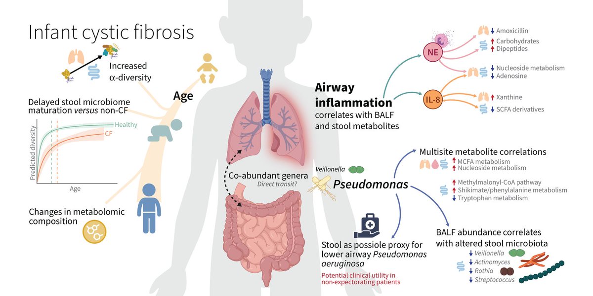 Our longitudinal study of the gut-lung-blood axis in early cystic fibrosis is out now, with accompanying editorial, in @ERSpublications erj.ersjournals.com/content/63/5/2… We explore potential biomarkers & targets for disease management & tailored treatments
