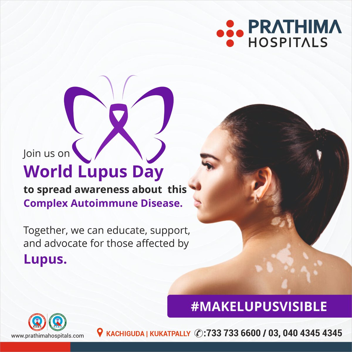 𝐖𝐨𝐥𝐫𝐝 𝐋𝐮𝐩𝐮𝐬 𝐃𝐚𝐲!

Together, we can educate, support, and advocate for those affected by
Lupus.

#WorldLupusDay #LupusAwareness #FightLupus #LupusWarrior #KnowLupus #LupusStrong #AutoimmuneDisease #LupusFighter #SupportLupus #LupusCommunity #prathimahospitals #PH