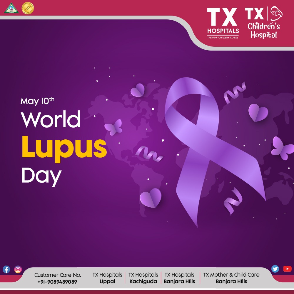World Lupus Day: Raise awareness and support for those battling this chronic autoimmune disease. Let's fight lupus together! #WorldLupusDay #LupusAwareness #TXH #TXHospitals