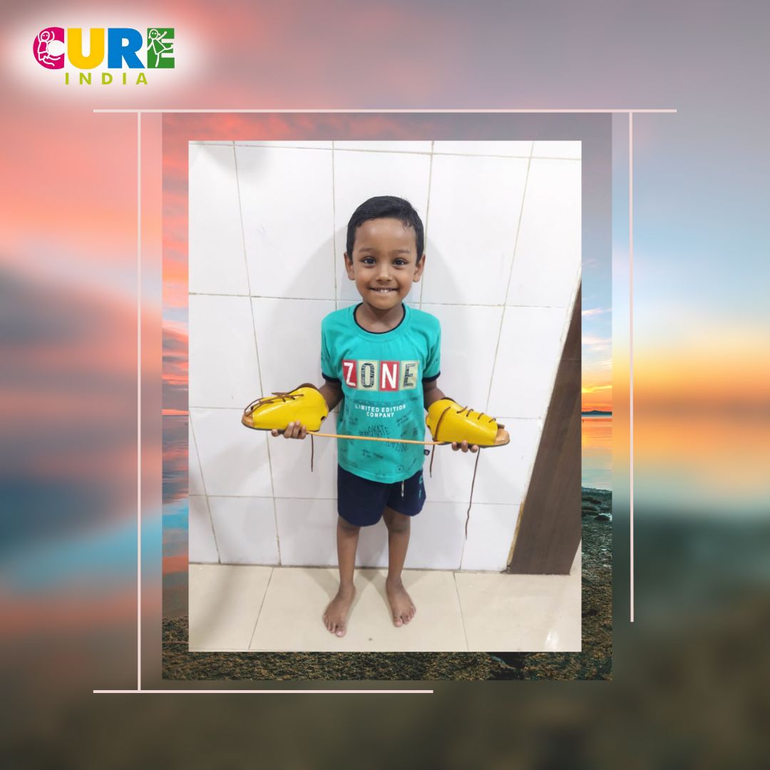 Introducing Ritika (Name changed), a courageous individual who has overcome clubfoot with the ongoing assistance of CURE India. 

#CUREIndia #ClubfootAwareness #EmpowerChildren #NoLimits #DonateForChange #CommunityImpact #InspiringJourneys