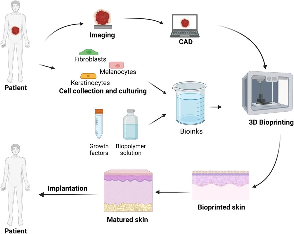 3D Bioprinting is a versatile method and closer to point-of-care applications, making it especially advantageous in emergency care. 
Read More: degruyter.com/document/doi/1…

#bioprinting #biomaterials #tissueengineering #skintissue #kosheeka #primarycells #cellculture #3dbioprinting