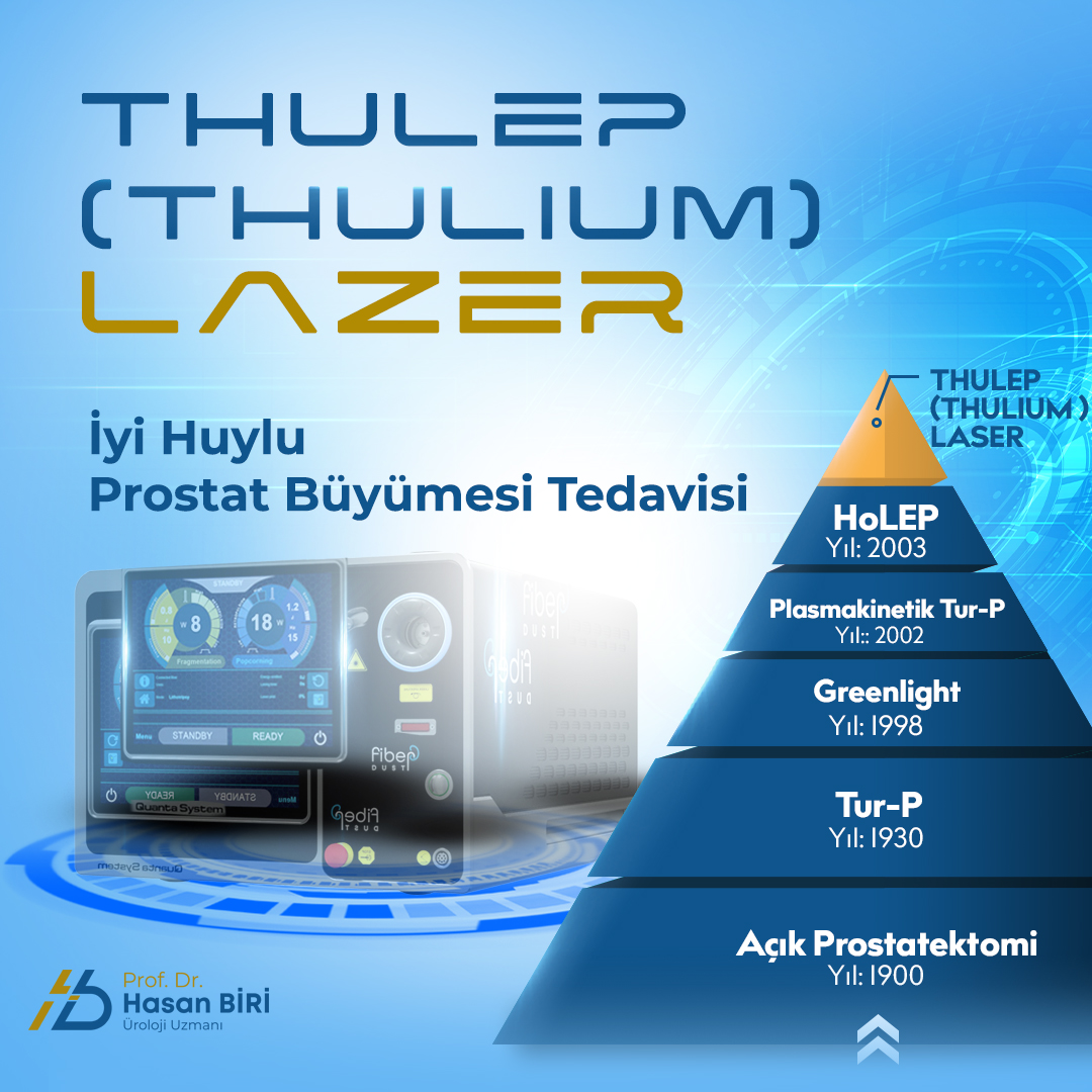 İyi huylu prostat büyümelerinde THULEP (THULİUM) LAZER
Cerrahide ileri teknoloji…

koruhastanesi.com/thulium-lazer-…