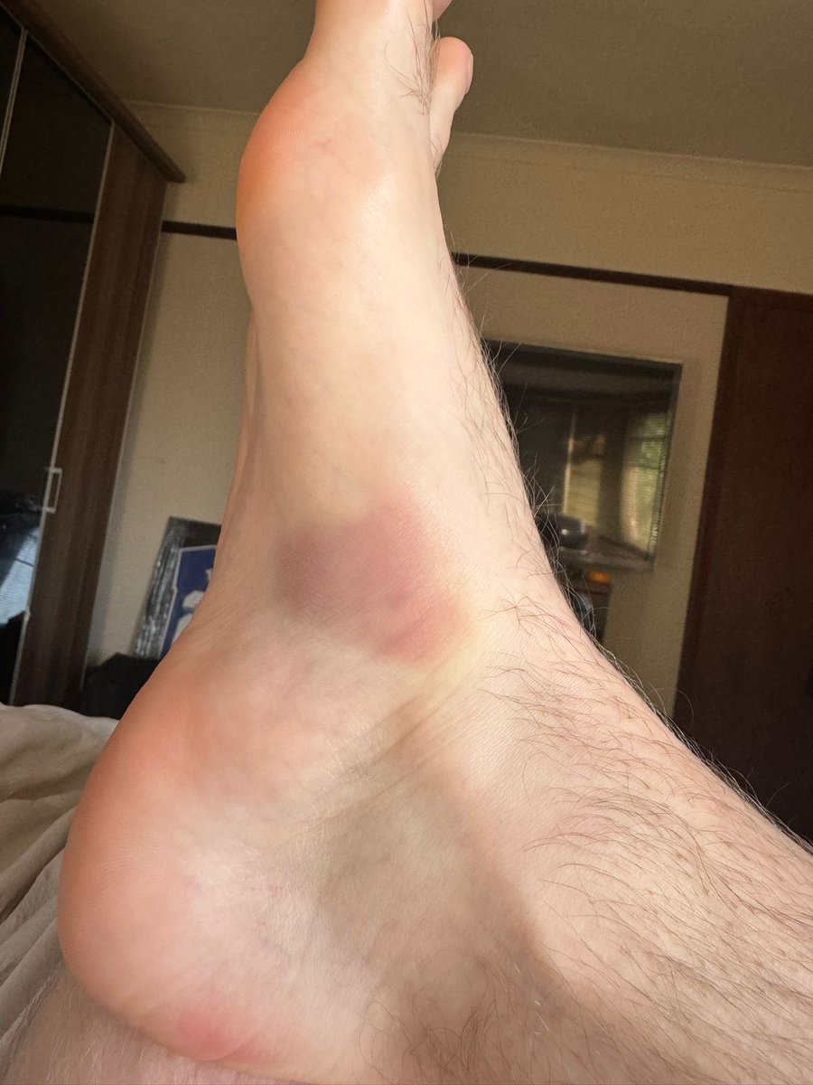 Fleggburgh FC would like to extend its deepest condolences to the Clements family, after the tragic passing of Joel Clements. 

Joel, Fleggburgh’s #4, suffered a catastrophic foot injury in yesterday’s cup final and passed away in the early hours of Friday. 

🚨: graphic content