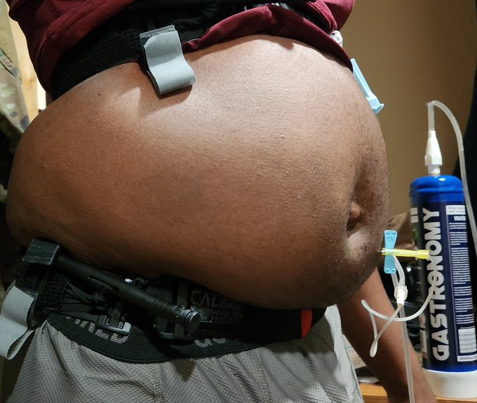 Just some n2o inflation from the other night. This will be the last time for a bit cauz I'm out of needles