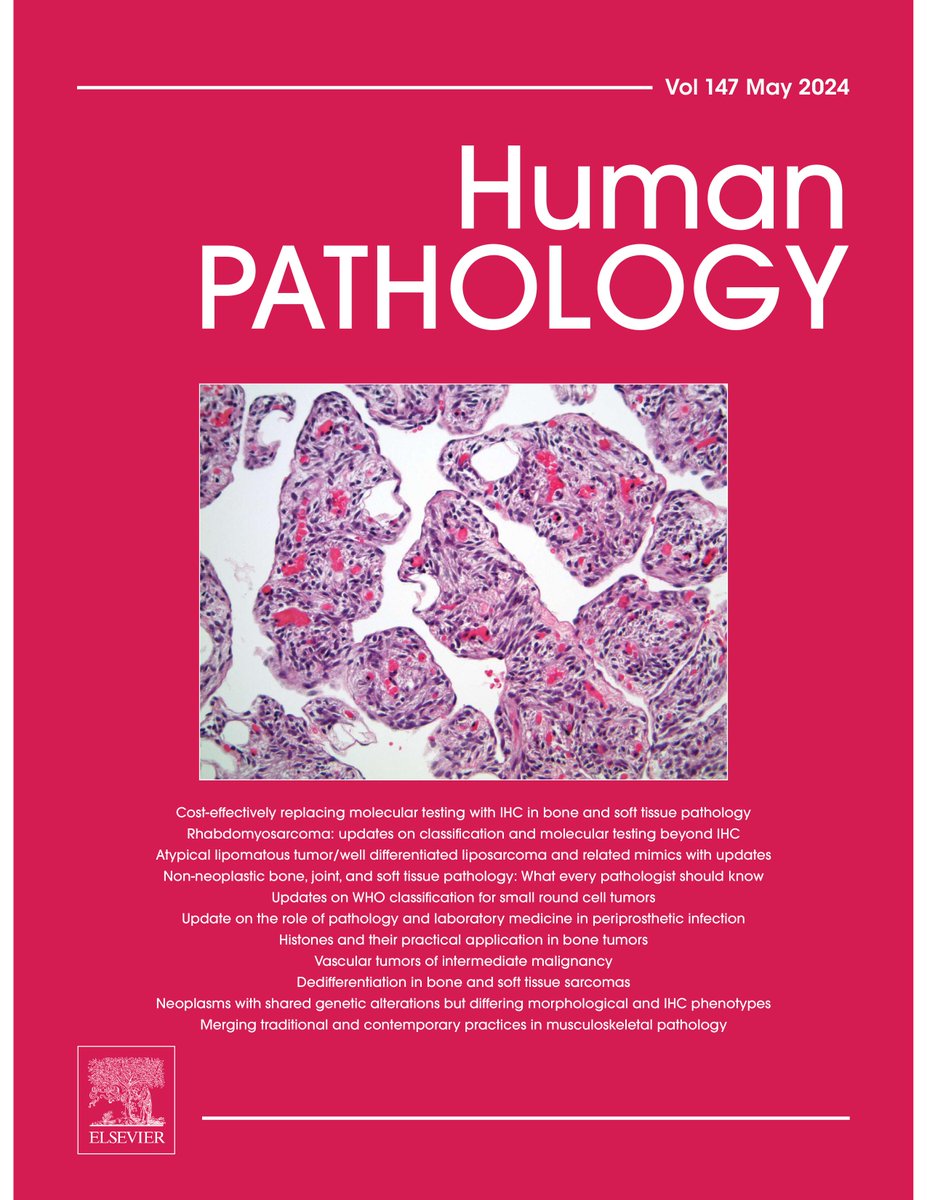 The May 2024 issue of #HumPathol is available online! This is a special issue on bone and soft tissue pathology, edited by @ScottBikeethan. sciencedirect.com/journal/human-… #pathology #PathTwitter #PathX #BSTpath
