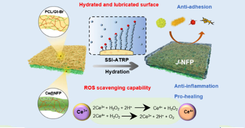 Development of a Janus nanofibrous patch (J-NFP) with asymmetric functions of #antiadhesion and pro-healing via sequential #electrospinning combined with subsurface-initiated atom transfer radical polymerization technologies. @sjtu1896 Read more: go.acs.org/9hO