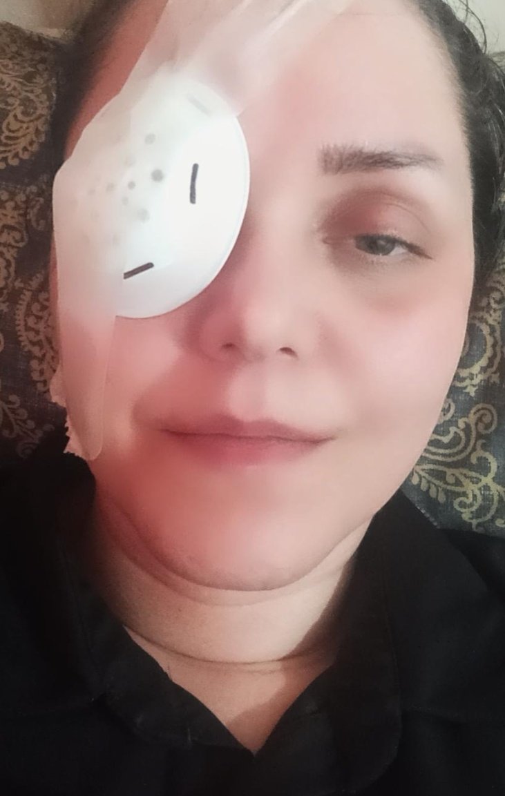 GM
Due to my eye surgery, my X activity has decreased, I will be back soon.
#NFTCommunity #NFTFam