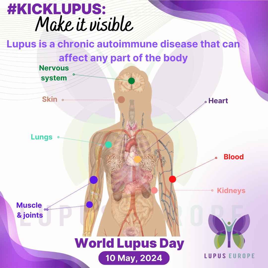 #Lupus is a complex and heterogeneous systemic autoimmune disease in which the body's immune system attacks your own tissues and organs, causing inflammation and damage in any part of the body Visit lupus100.org for more! #WorldLupusDay #MakeLupusVisible #Lupus100