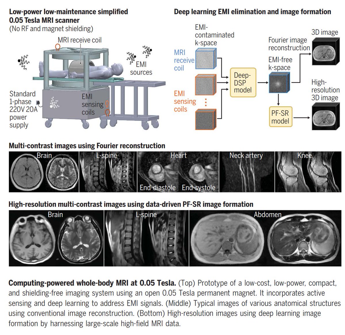 Intriguing paper in this week's Science: a new, much cheaper approach for MRI scanning  

It's an MRI scanner that uses a 0.05 Tesla magnet (vs. the current 1.5 - 3 T) and operates at a fraction of the cost (~$22,000 for the hardware), time (&lt;10 minutes), and noise of a current