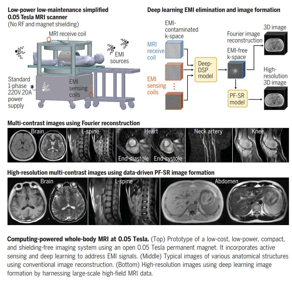 Intriguing paper in this week's Science: a new, much cheaper approach for MRI scanning It's an MRI scanner that uses a 0.05 Tesla magnet (vs. the current 1.5 - 3 T) and operates at a fraction of the cost (~$22,000 for the hardware), time (<10 minutes), and noise of a current…