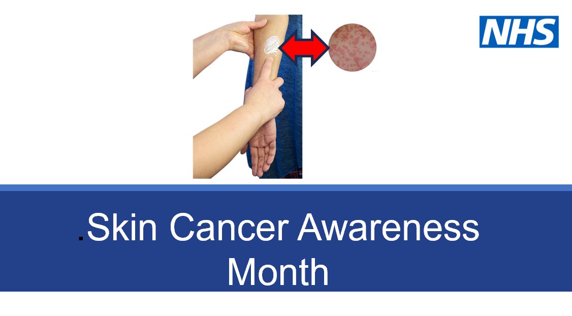 It's skin cancer awareness month! Here's some important information about a type of skin cancer called Melanoma. It's helpful for carers to learn more about this, to keep themselves and the people they care for, safe. 
nhs.uk/conditions/mel…
