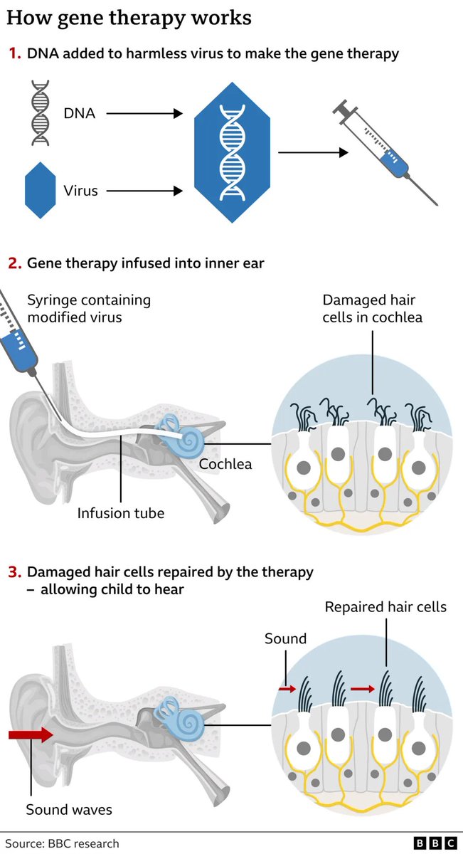 Gene therapy breakthrough 

✅UK girl regains hearing in landmark treatment.

🧬How Gene Therapy Works:  Infographics (BBC Research)