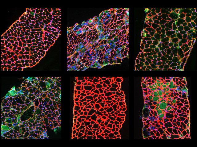 Novel mouse model of #Duchennemusculardystrophy #DMD that has variation in #immuneresponse & effects on #muscle, as in humans. Image & research by Kristy Swiderski et al @GordonSLynch lab @UniMelb in @DMM_Journal. Article link & massive BPoD archive on bpod.org.uk/archive/2024/5…