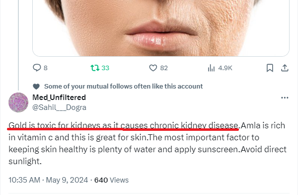 AyurvedaMonk's tweet photo. Swarna Bhasma is NOT at all Toxic @Sahil___Dogra 
& 
if you search "Safety studies of Swarna Bhasma" you may easily get around 912 research publications within 0.07 seconds (See Pic. 01) - But you'll not waste even these 0.07 seconds because for you it's very easy to vomit your hatred for Ayurveda within Nano-seconds.
😂
If your superiority complex still does not allow you to search these research publications, then please read a small screenshot (Pic.-02) I am sharing here to increase your commonsense.

& Yes, the public is not i_diot like you - By making such irrational comments about #Ayurveda, you people are damaging yourselves only.

Good Day.