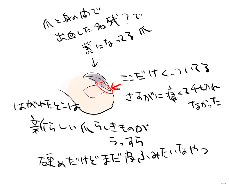 3ヶ月くらい前に痛めた足の爪がさっき剥がれたっていう日記

痛くは全然ない 