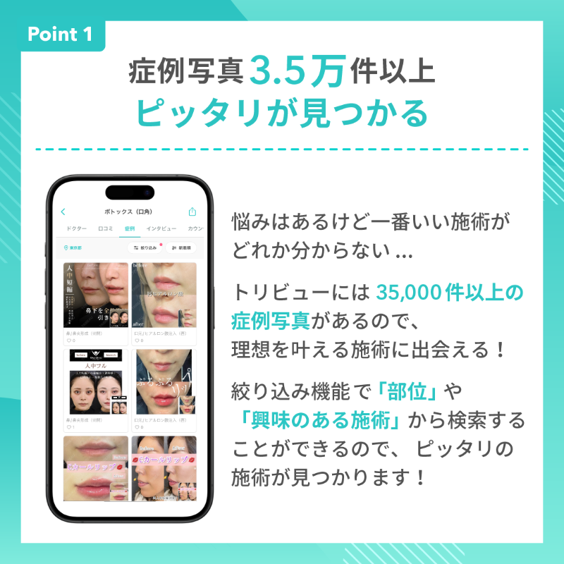 tribeauJP's tweet photo. トリビュー×MEDIHEAL
　豪華コラボ企画🎁🌸

#トリビューコラボキャンペーン
MEDIHEALのシートマスクを抽選で100名様にプレゼント✨！

▼応募条件
①このアカウントをフォロー＋リポスト
②アプリの会員登録👉https://t.co/aRBQz3PRGD

▼応募期間
5/13(月)~5/27(月)

対象者にはDMでご連絡💌