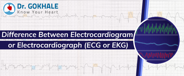 DrGokhaleAGK's tweet image. Difference Between #Electrocardiogram or #Electrocardiograph (#ECG or #EKG)

After reading the terms, one might be confused about which test does what and what is the real difference between them. An ECG and an EKG are two abbreviations..

Know more at: drgokhale.com/blog/differenc…