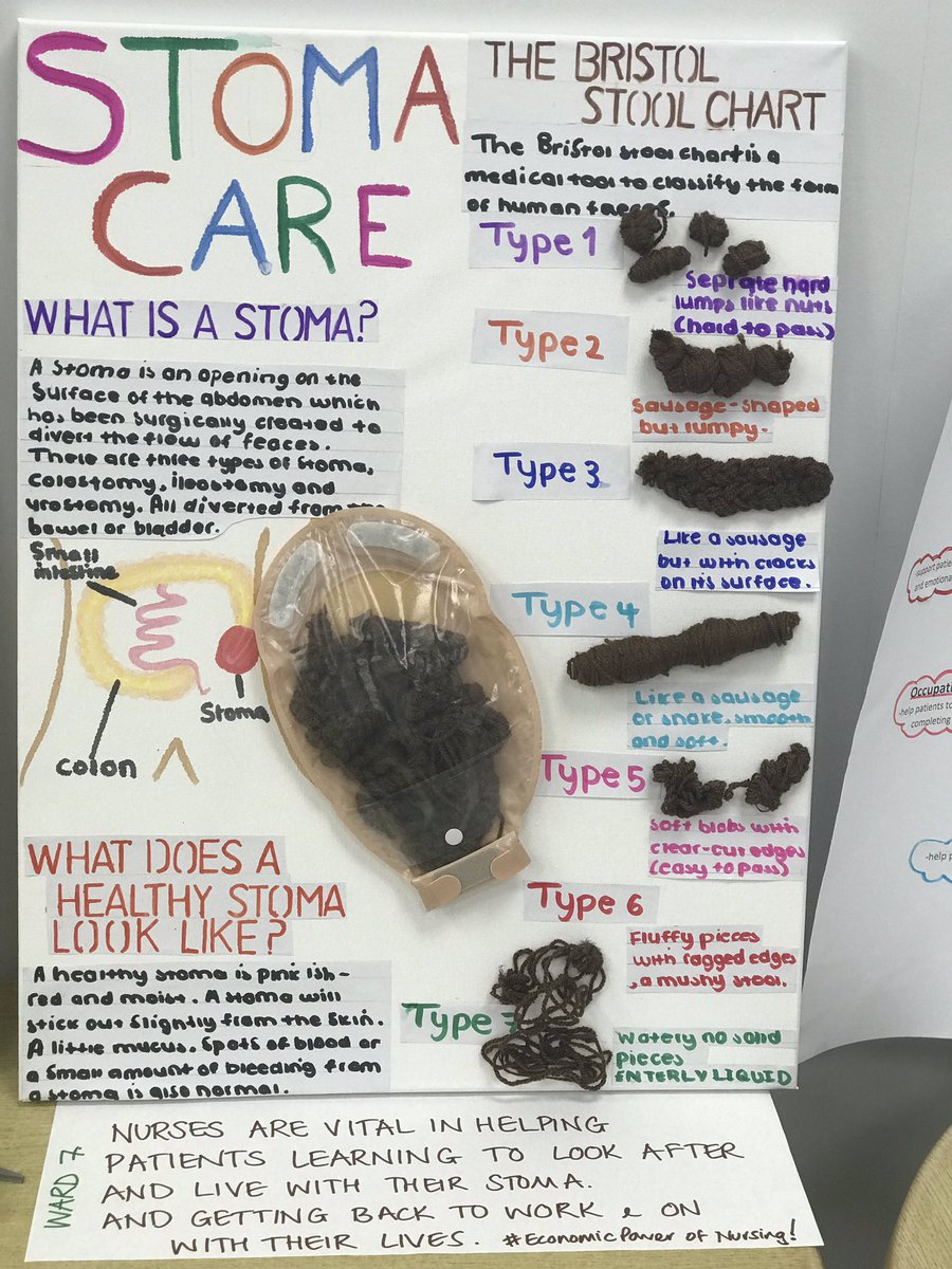 sianymarv's tweet image. International Nurses Day 2024
Theme this year - ‘The Economic Power of Care’ … some head scratching from staff.. and then they rose to the occasion for our annual poster competition! 👏🏼👏🏼👏🏼#IND24 #HywellDdaNurses #TeamPPH 
@HywelDdaHB @meinir23 @sianyhopkins  @SharonDan111