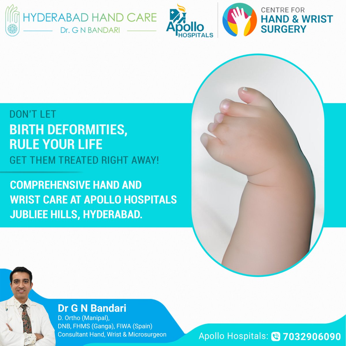 Don't let #BirthDeformities, rule your Life.
Get them #treated right away !
Comprehensive Hand and Wrist care at #ApolloHospitals, #JubileeHills, #Hyderabad. Let us help you find relief.

Dr. GN Bandari
Hand , Wrist & Micro-Surgeon
Book an Appointment
7032906090