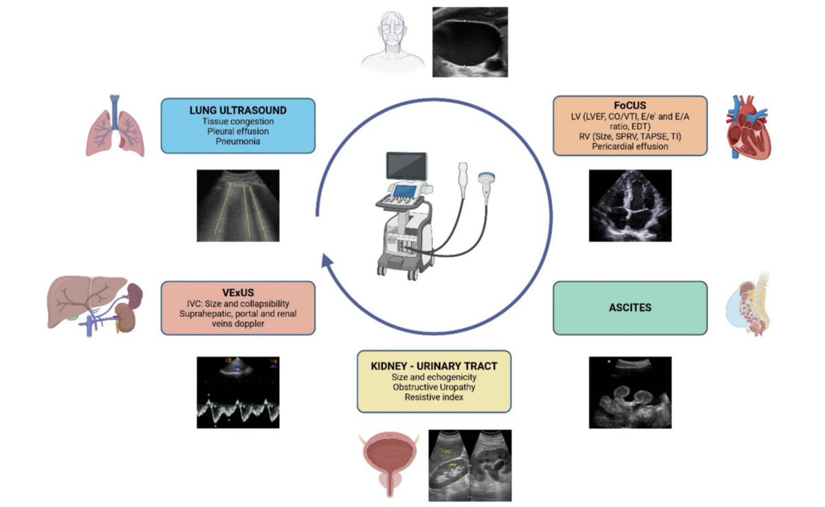 Utilidad de la ecografía en el fallo renal del paciente cirrótico. ⬇️ https:/doi.org/10.1093/ckj/sfae112 @AEcodigest