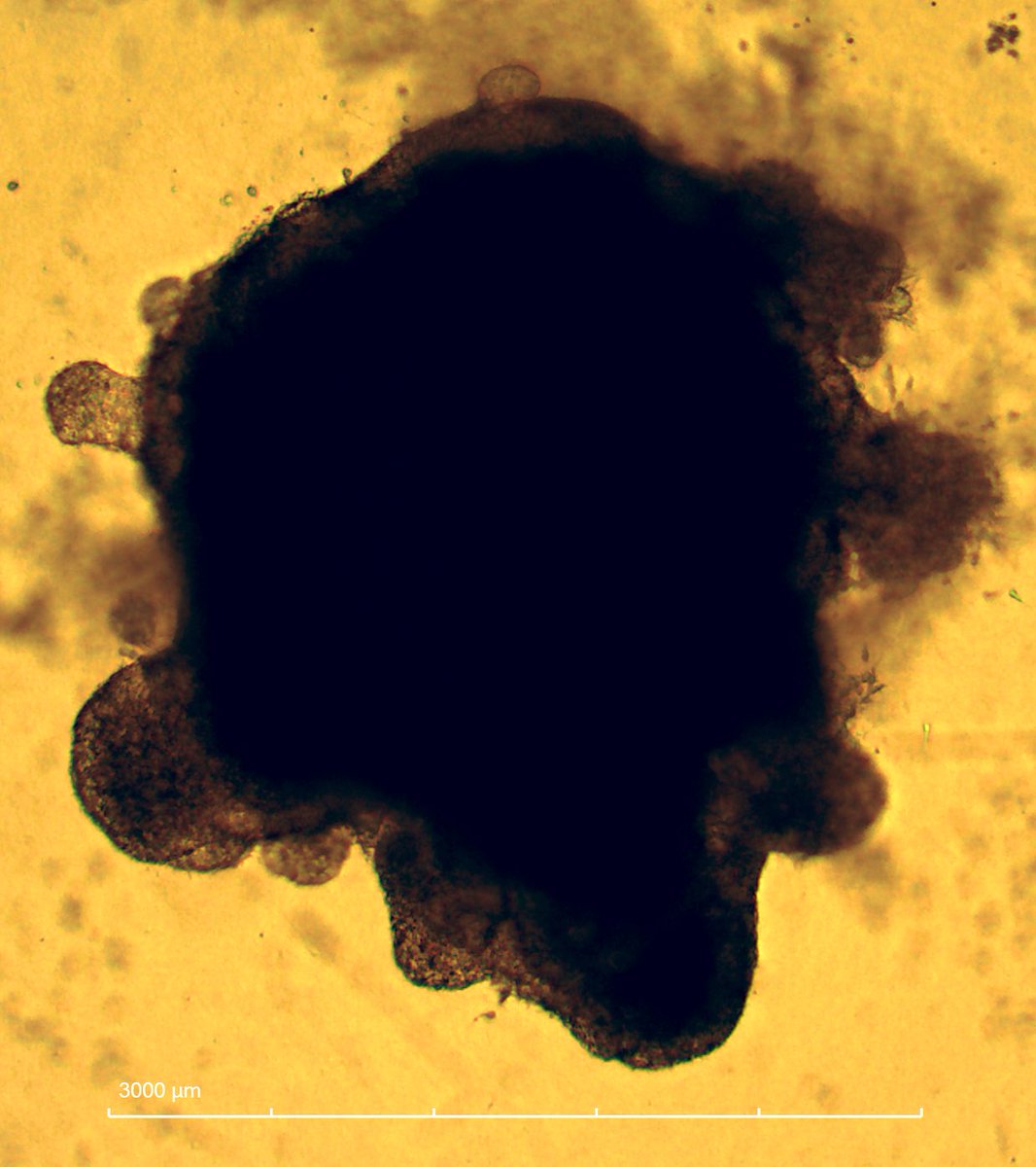 SevdeAltuntas's tweet image. Deri organoidlerinde bugün ❤️
#AltuntasLab @necatia25 @ecekyz