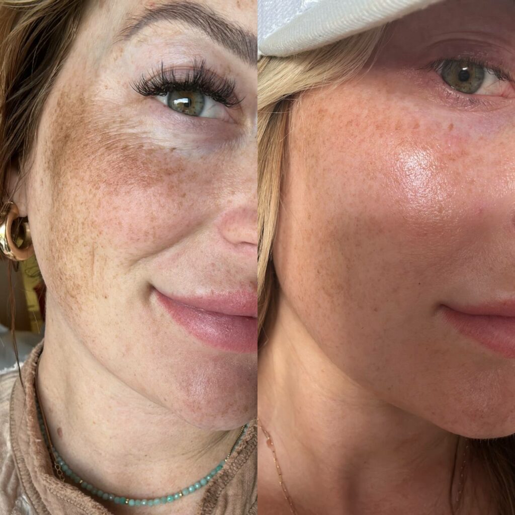 No #Botox #Fake Botox #Injections #Surgery needed Try Now*us.olivetreepeople.com/?referral=Lori Last 50 yrs, #skin diseases increased 500%. 95% #beauty products are fillers, water, refined oil. Waterless Beauty growing 140% faster than 'conventional' skin care Big difference!
